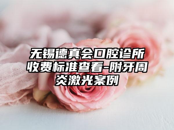 无锡德真会口腔诊所收费标准查看-附牙周炎激光案例