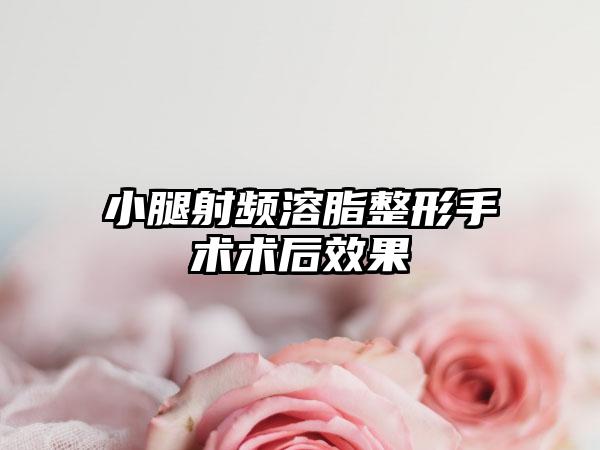 小腿射频溶脂整形手术术后效果