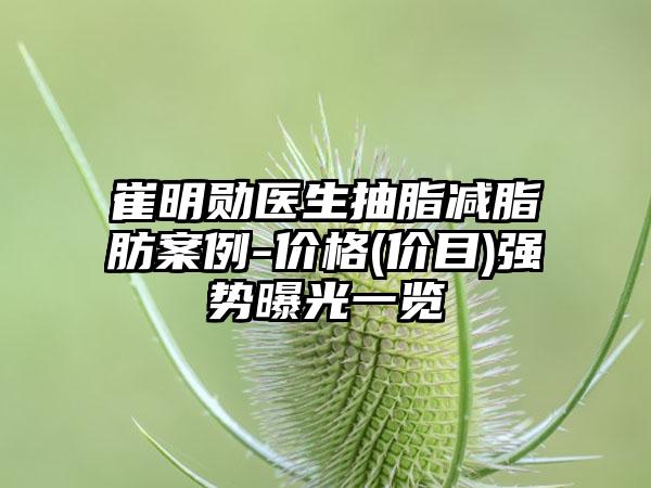 崔明勋医生抽脂减脂肪案例-价格(价目)强势曝光一览