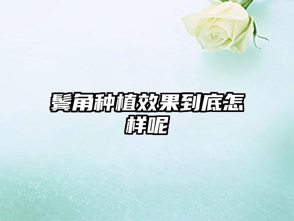 鬓角种植效果到底怎样呢