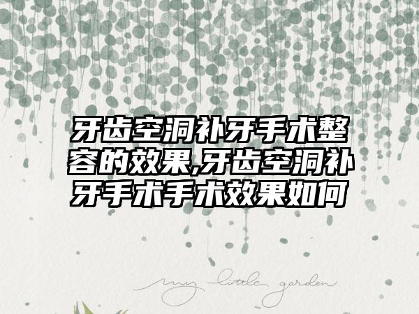 牙齿空洞补牙手术整容的效果,牙齿空洞补牙手术手术效果如何