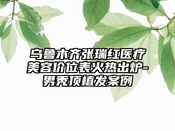 乌鲁木齐张瑞红医疗美容价位表火热出炉-男秃顶植发案例