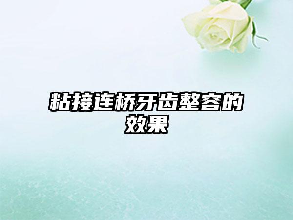 粘接连桥牙齿整容的效果