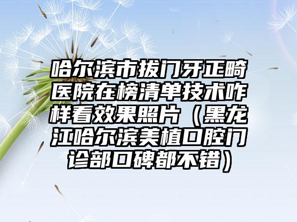 哈尔滨市拔门牙正畸医院在榜清单技术咋样看效果照片（黑龙江哈尔滨美植口腔门诊部口碑都不错）