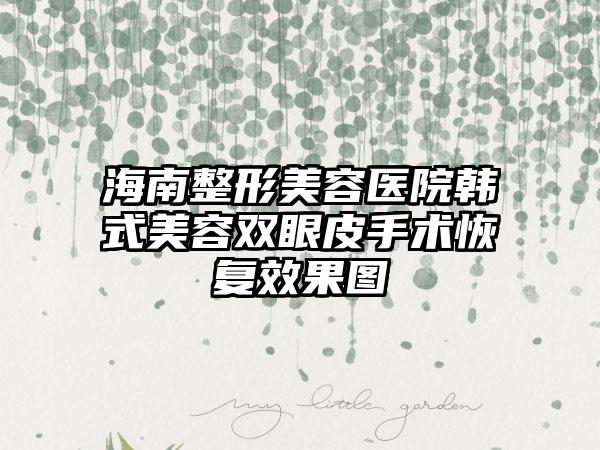 海南整形美容医院韩式美容双眼皮手术恢复效果图