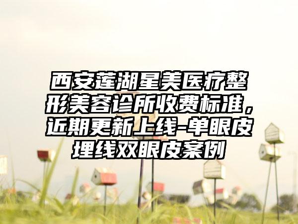 西安莲湖星美医疗整形美容诊所收费标准，近期更新上线-单眼皮埋线双眼皮案例