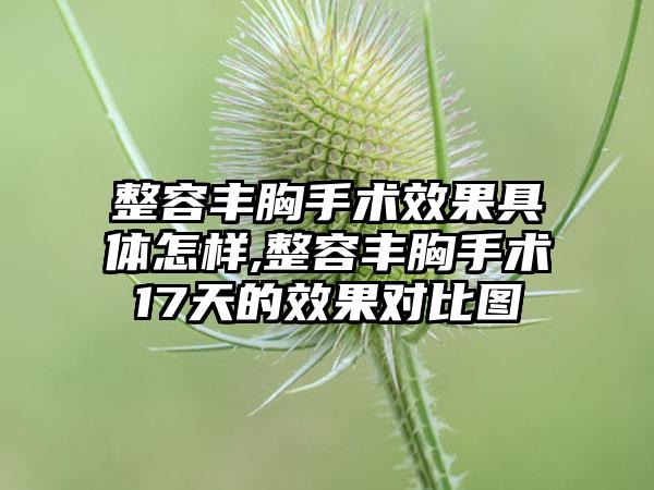 整容丰胸手术效果具体怎样,整容丰胸手术17天的效果对比图