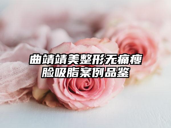 曲靖靖美整形无痛瘦脸吸脂案例品鉴