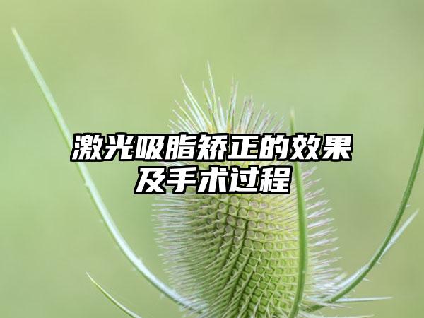 激光吸脂矫正的效果及手术过程